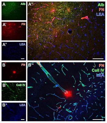 Increased Immunosignals of Collagen IV and Fibronectin Indicate Ischemic Consequences for the Neurovascular Matrix Adhesion Zone in Various Animal Models and Human Stroke Tissue